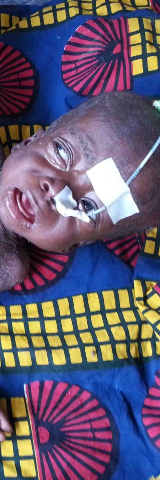 Malaria, mässling och malnutrition (undernäring) är tre mycket vanliga sjukdomar hos barn i Katanga, Kongo-Kinshasa. 