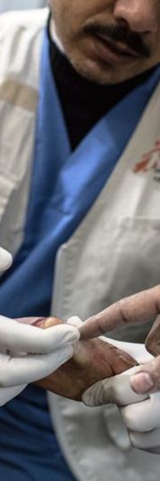 En brännskadad patient får såren omlagda på Läkare Utan Gränsers postoperativa klinik i Gaza. På grund av de täta bombningarna är det svårt för patienter och hjälparbetare att förflytta sig i Gaza. FOTO: Chris Huby