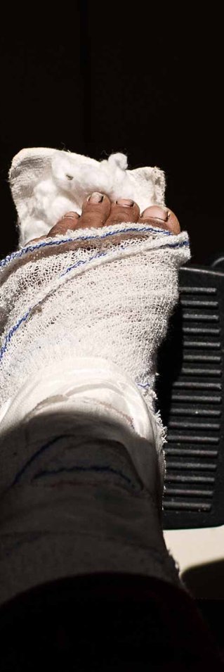 I Irak finns fortfarande landminor och granater som inte har exploderat. På bilden, femåriga Faten som skadat sitt ben.