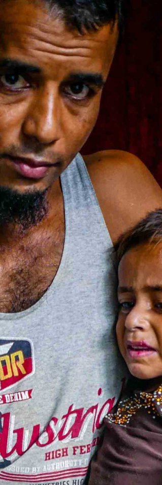 Den tioåriga flickan som togs omhand på vår vårdcentral i Cox's Bazar, Bangladesh. Här tillsammans med sin pappa.