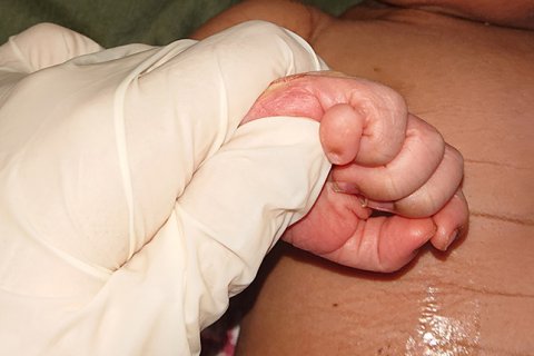 En hand i en läkarhandske som håller i ett litet barns hand