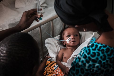 En nyfödd bebis i Guinea-Bissau sondmatas.