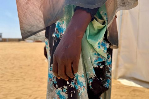 Närbild på kvinnohand