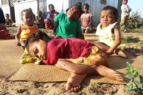 Det finns många typer av medfödda sjukdomar och missbildningar, som ofta beror på undernäring. I denna familj har alla fem barn skador på skelettet.