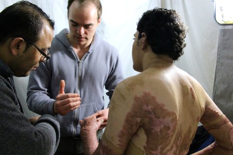 Arkitektstuderanden Nadir, 20, skadades när en gasbehållare exploderade under Gazakriget sommaren 2014. De svåra brännskadorna kräver kirurgisk vård på Läkare Utan Gränsers klinik i Gaza för att förbättra hans rörelseförmåga. 