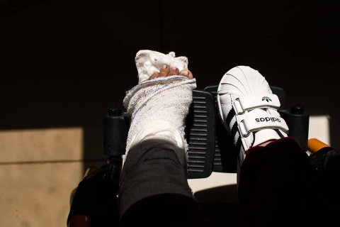 I Irak finns fortfarande landminor och granater som inte har exploderat. På bilden, femåriga Faten som skadat sitt ben.