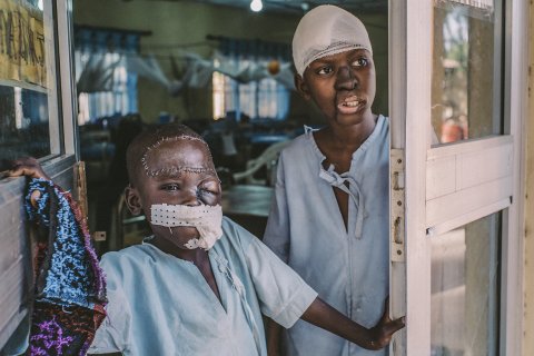 Åttaåriga Umar och femtonåriga Adamu står vid ingången till den postoperativa avdelningen på Sokoto sjukhus.