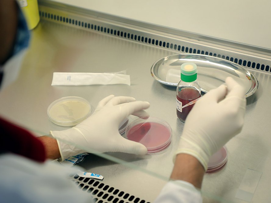 Bild på person med gummihandskar som håller i en pimpett i ett laboratorium i Aden, Jemen, där vi testar vilken typ av antibiotika som behövs.
